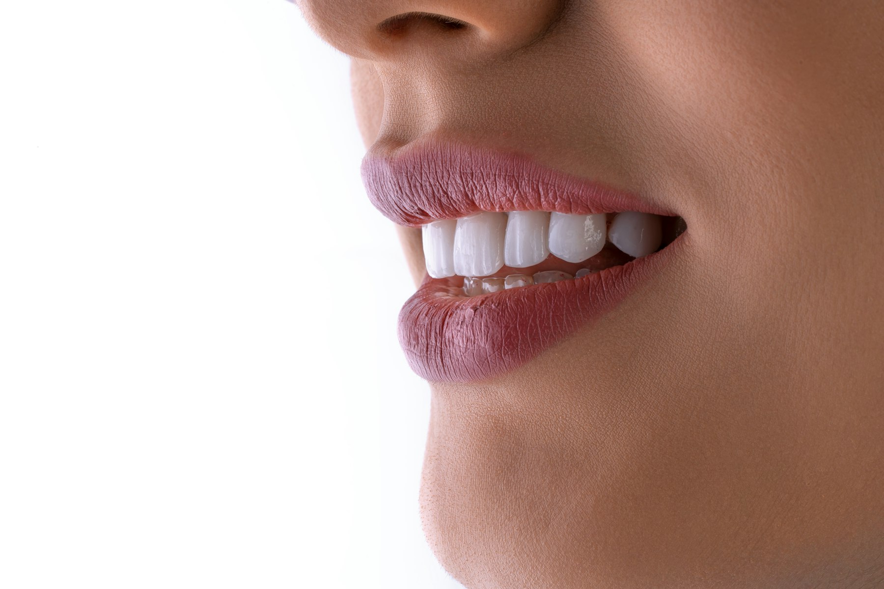 Illustrative close-up of a patient's porcelain veneer smile, not the actual clinic
